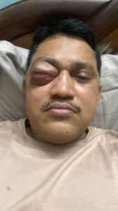 MY JOURNEY WITH A RARE TUMOUR BEHIND EYE 73 FFAE2996