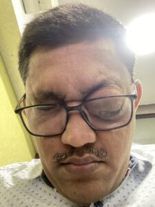 MY JOURNEY WITH A RARE TUMOUR BEHIND EYE 93 IMG 4252