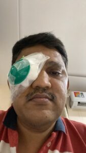 MY JOURNEY WITH A RARE TUMOUR BEHIND EYE 84 PSTT5567
